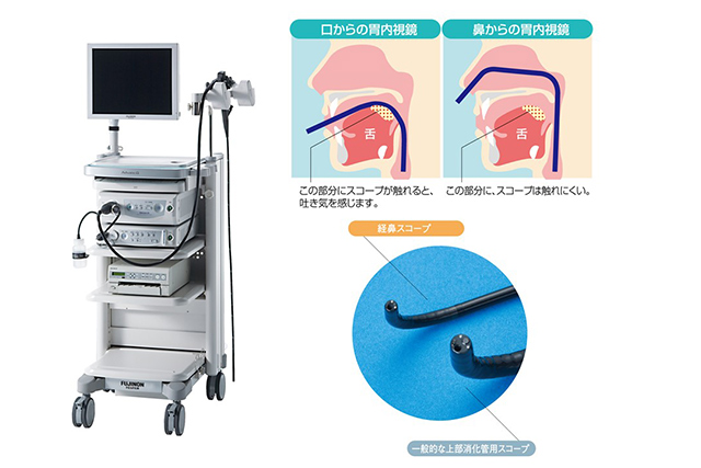 胃カメラ（経口内視鏡・経鼻内視鏡）